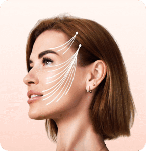 Full face botox (60 unidades)
