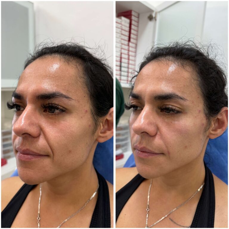 Resultado real de hilos tensores en Eternal Glow, CDMX