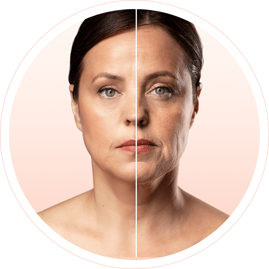 Comparación de antes y después mostrando resultados de rejuvenecimiento facial con Sculptra en CDMX