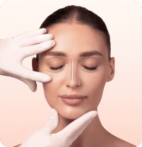 Baby botox (30 unidades)