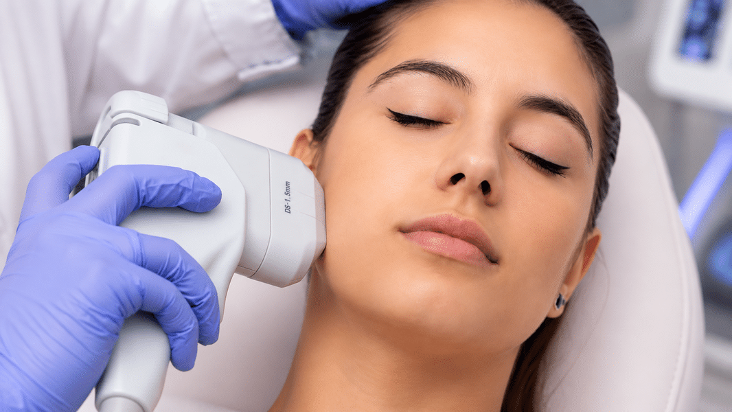 HIFU facial en CDMX aplicado sobre la mejilla por una especialista con guantes clínicos.