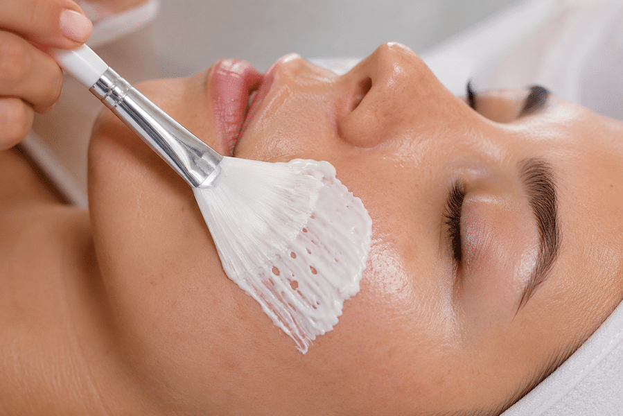 Aplicación de producto para peeling facial con pincel sobre la mejilla durante un tratamiento estético.